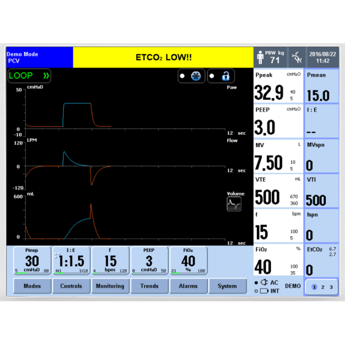 Compact Size Siriusmed Ventilator Patient Settings Automatic Stored 0